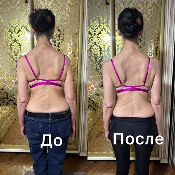 Спина, вид сзади: фото до и после