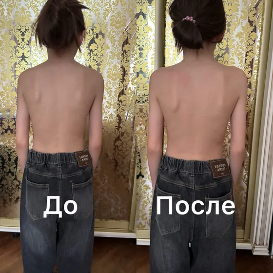 Осанка у ребёнка, спина: фото до и после первого сеанса